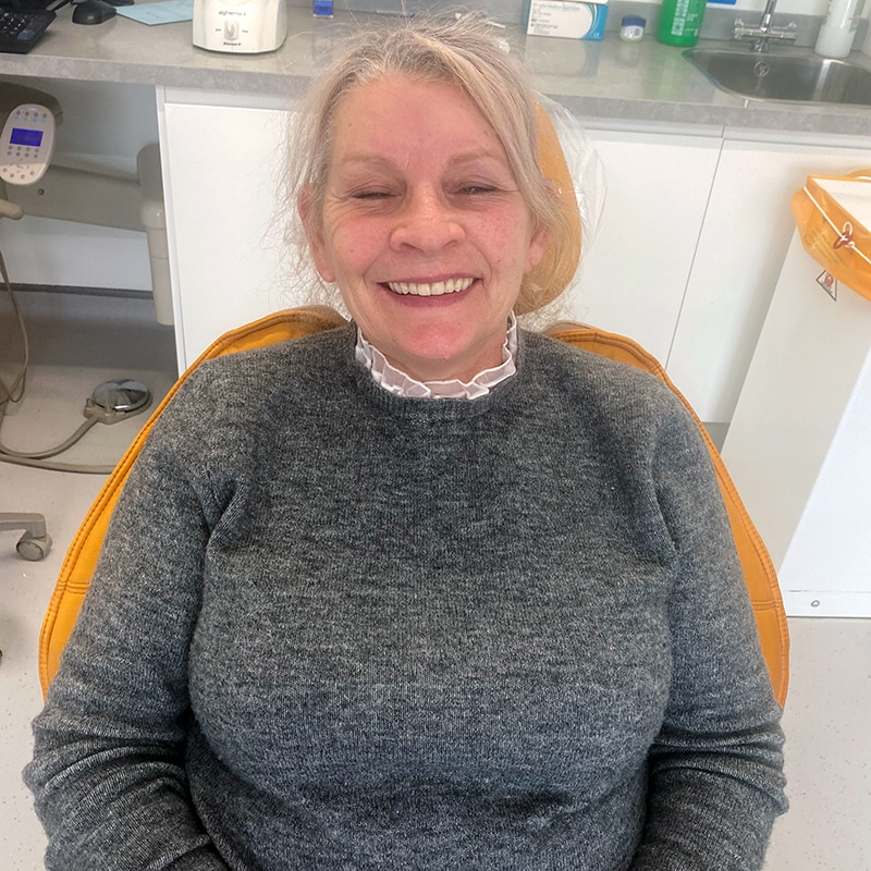 Full upper denture - Fantastic Smile