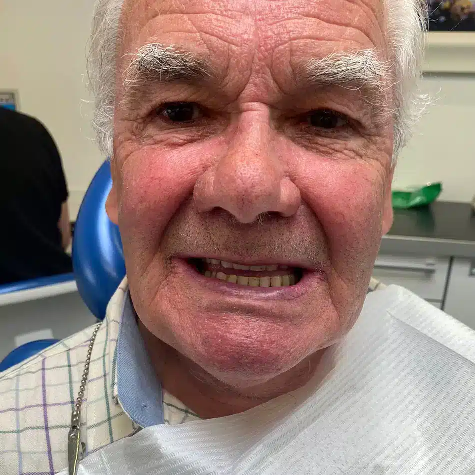 new-dentures-glasgow-clinic-before-2 new-dentures-glasgow-clinic-before-2